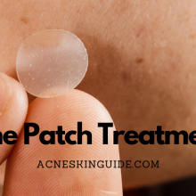 Acne Patch Treatments