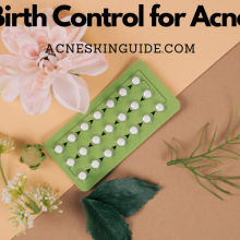 Birth Control for Acne