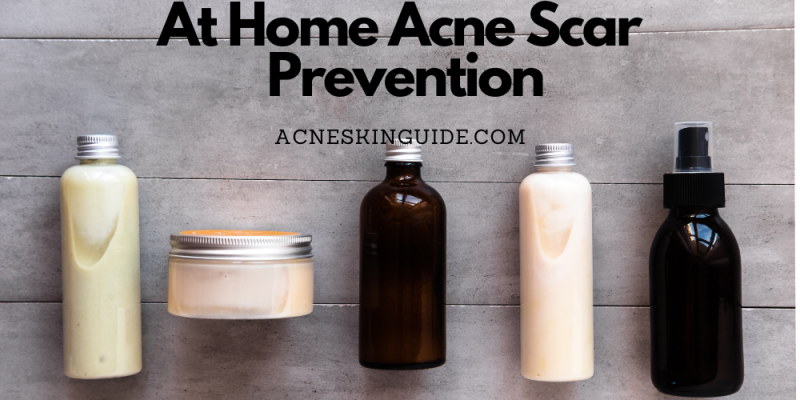 At Home Acne Scar Prevention