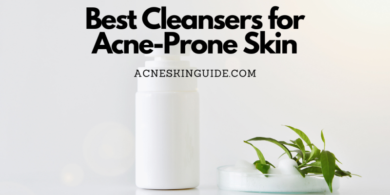 Best Cleansers for Acne-Prone Skin