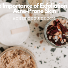 The Importance of Exfoliation for Acne-Prone Skin