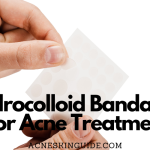 Hydrocolloid Bandages For Acne Treatment