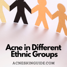 Acne in Different Ethnic Groups