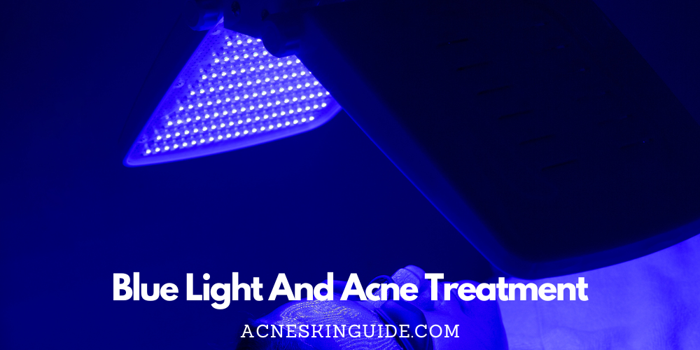 Blue Light And Acne Treatment